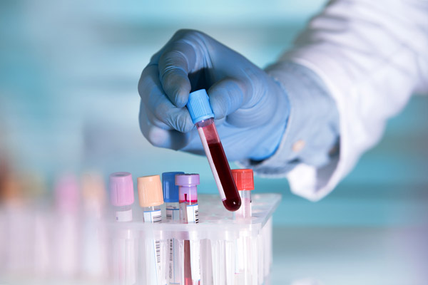 Understanding Blood Work: Key Tests Your Primary Care Recommends